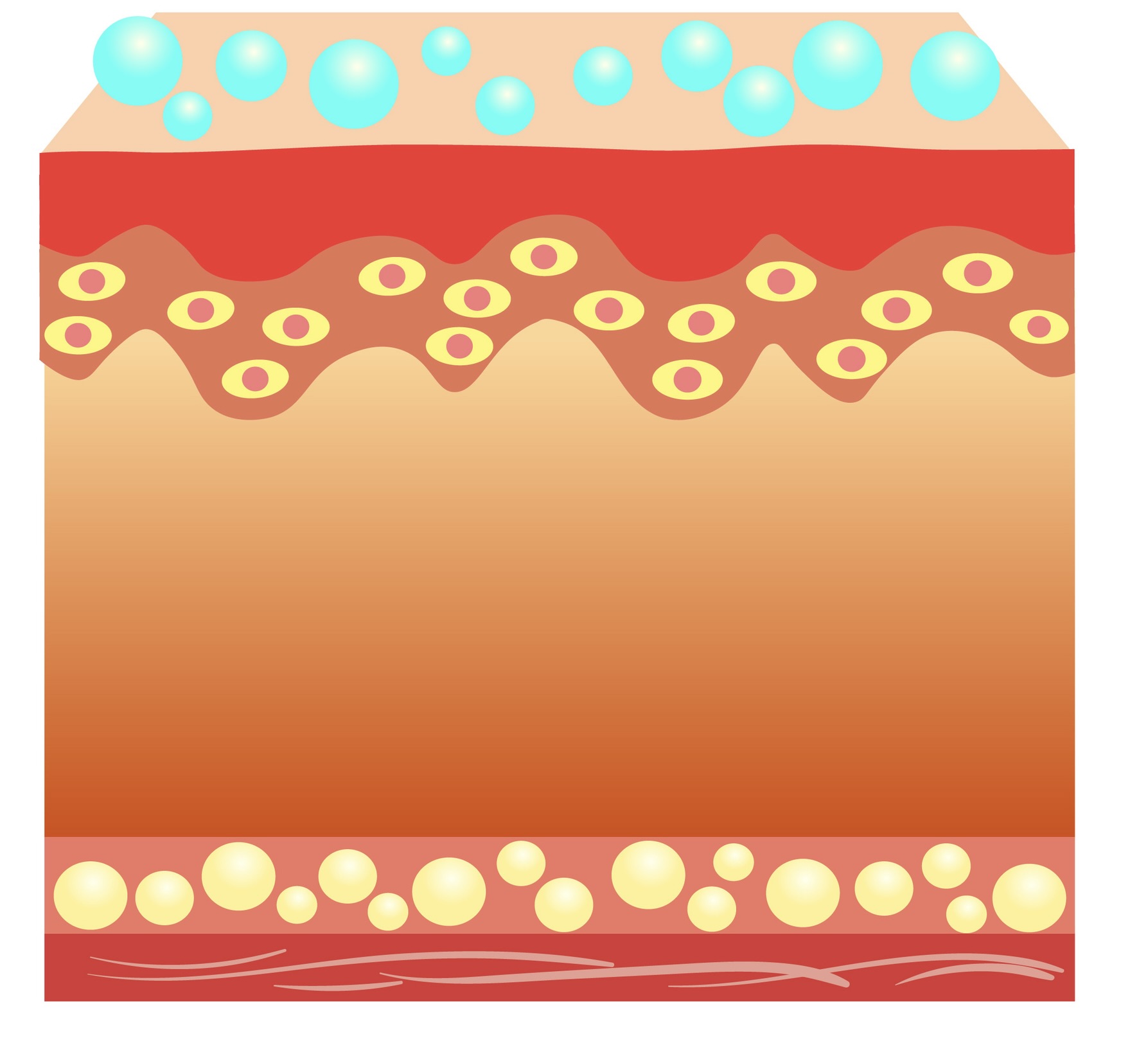 L’acide hyaluronique de haut poids moléculaire 