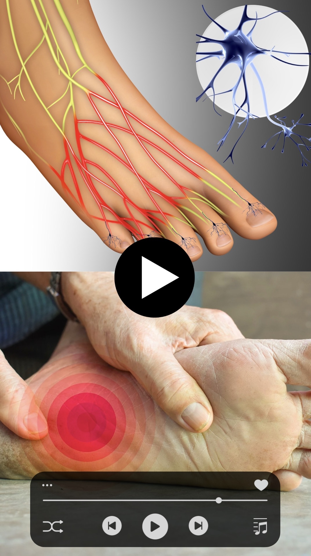 vignette vdt vit mobile