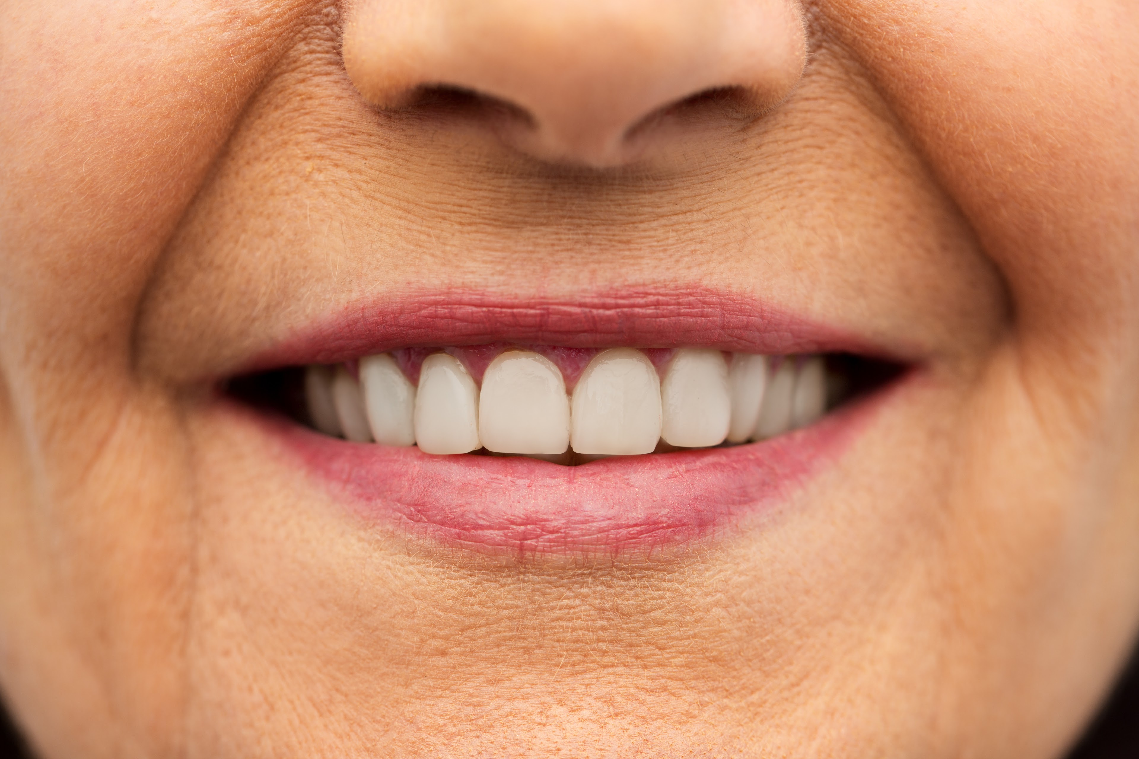 sourire