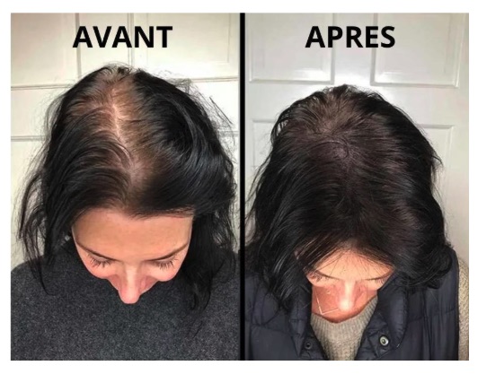 ECA avant apres femme
